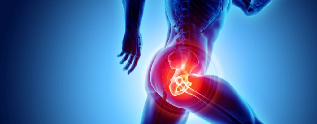 HIP JOINT : Radiating pain