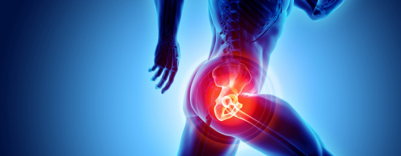HIP JOINT : Radiating pain