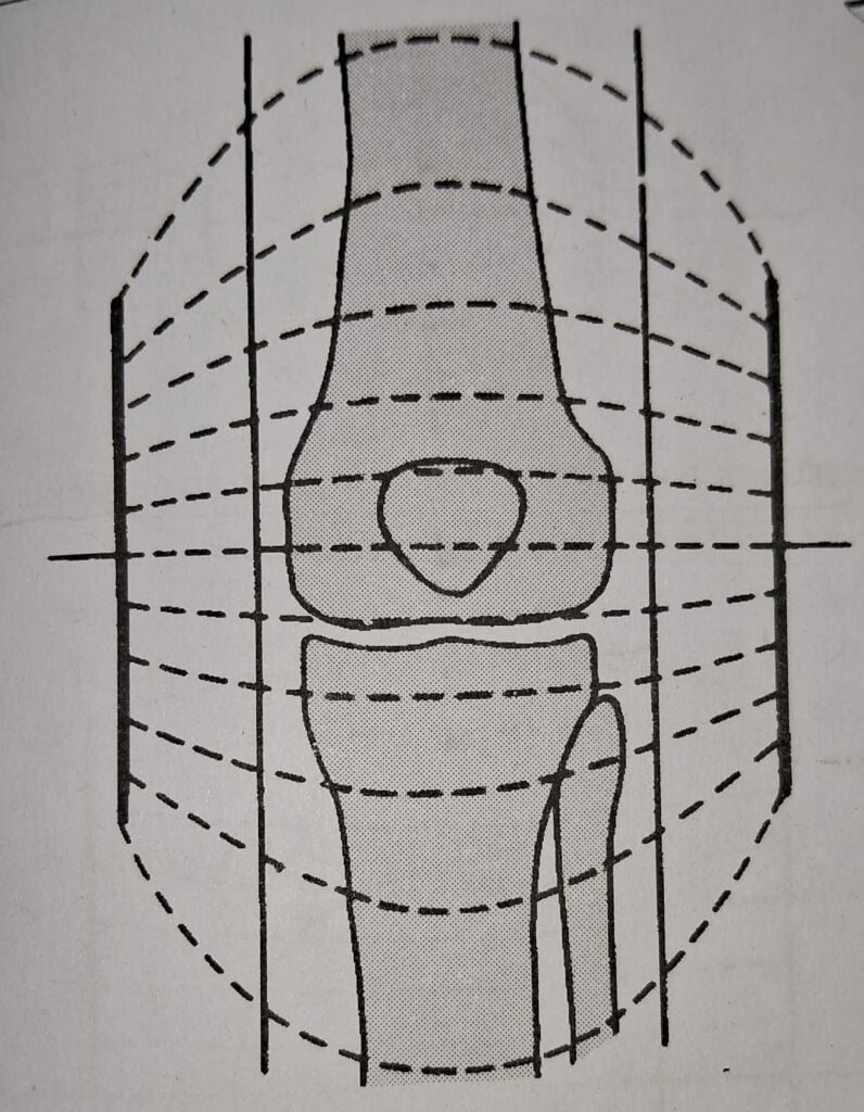 Uniform electrodes:When a correct size electrodes are used uniform part of electric field in an joint. in SWD
