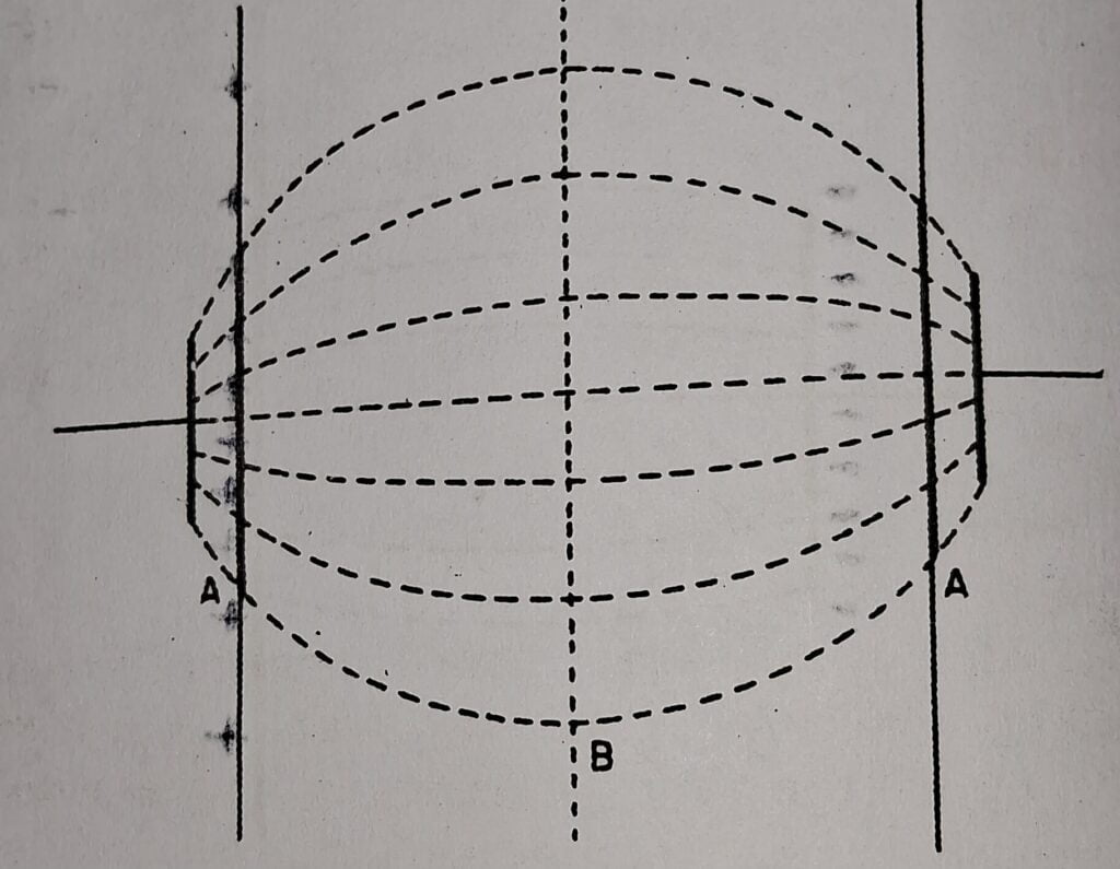 Short-wave diathermy :Electrodes close to body surface