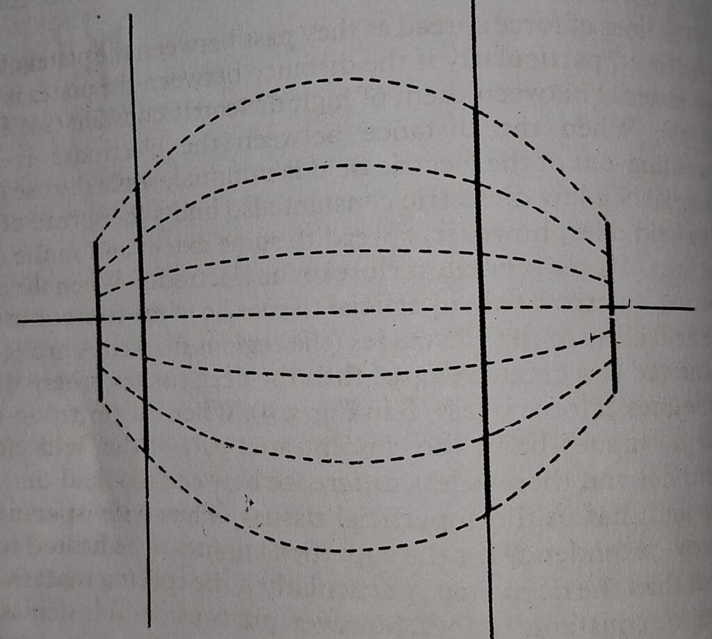 Short-wave diathermy : non uniform placement of electrode