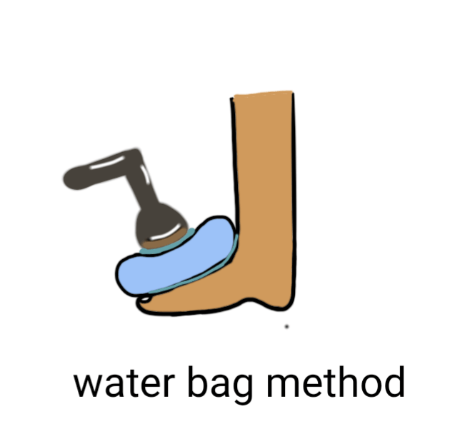 Ultrasound :Water bath method of application