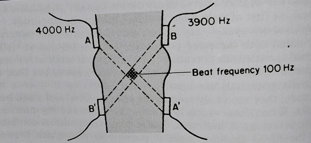 interferential therapy
