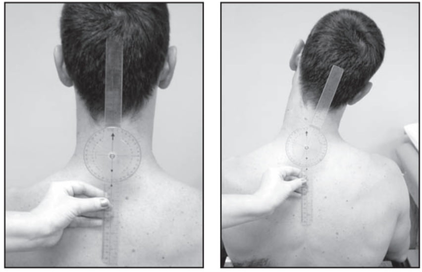 Goniometry of the cervical spine