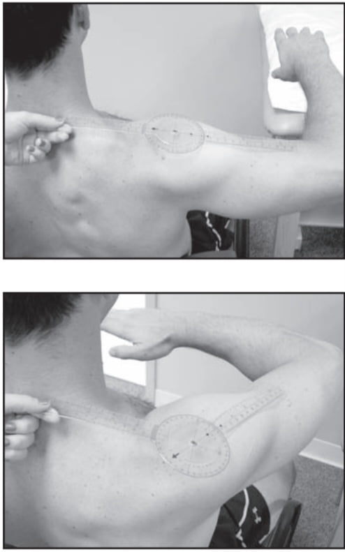 Goniometry of shoulder joint