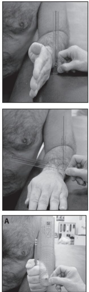 Forearm Pronation