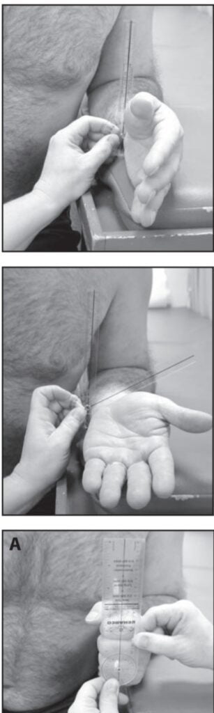 Forearm Supination