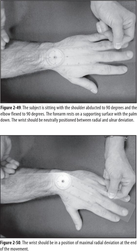 Wrist radial deviation
