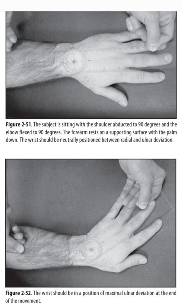 Wrist Ulnar deviation