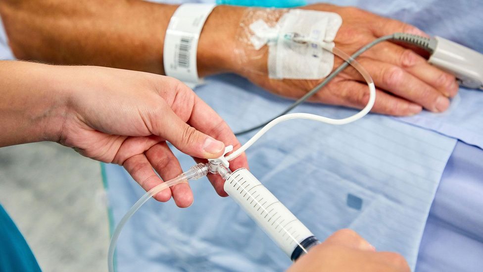General anesthesia