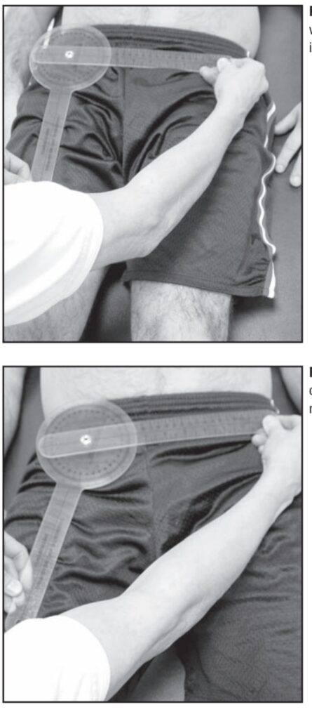 Goniometry of hip abduction