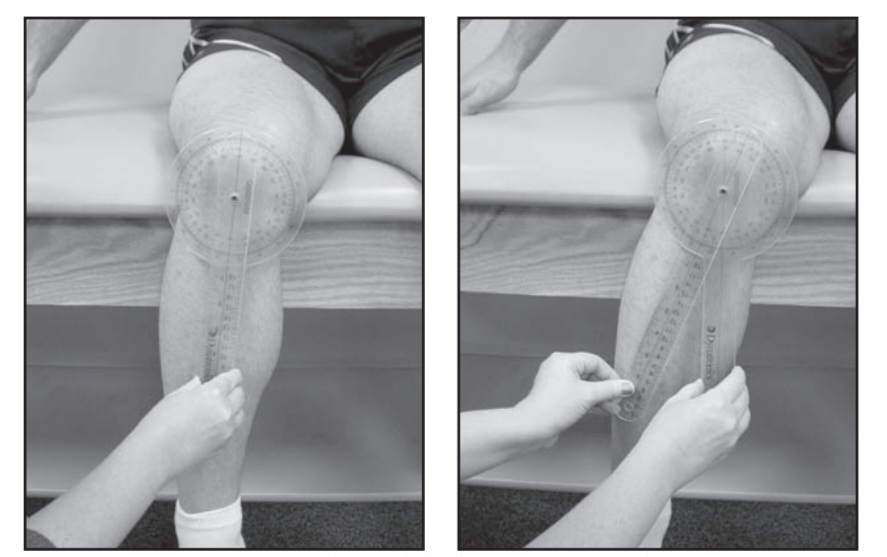 Goniometry of hip internal rotation