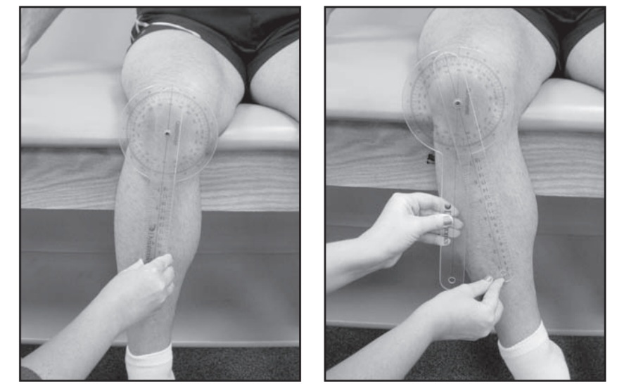 Goniometry of hip external rotation