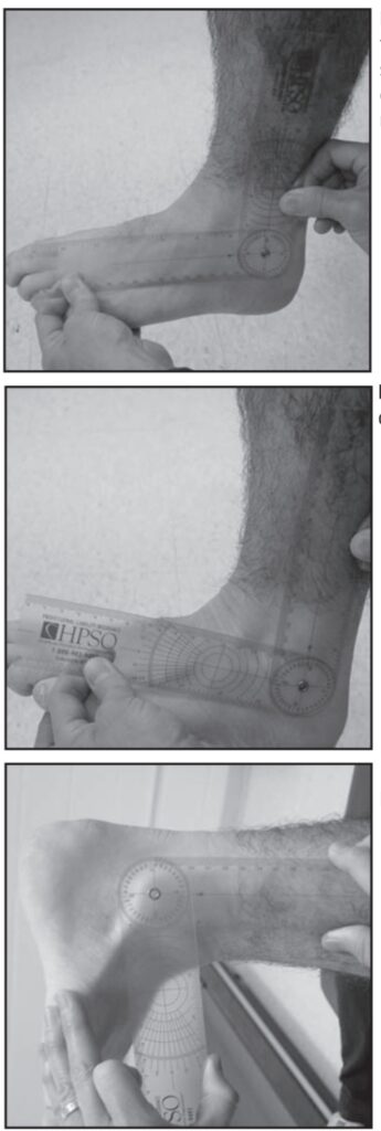 Goniometry of Ankle dorsiflexion