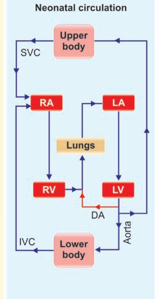 Neonatal circulation flow chart