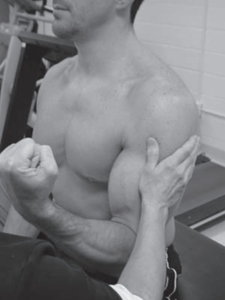 MMT of Elbow flexion Grades 3/5 to +2/5