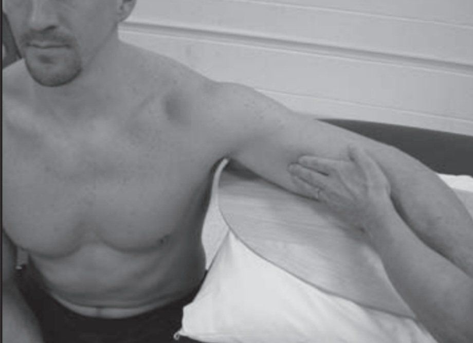 MMT of elbow flexion Grades 1/5 to 0/5