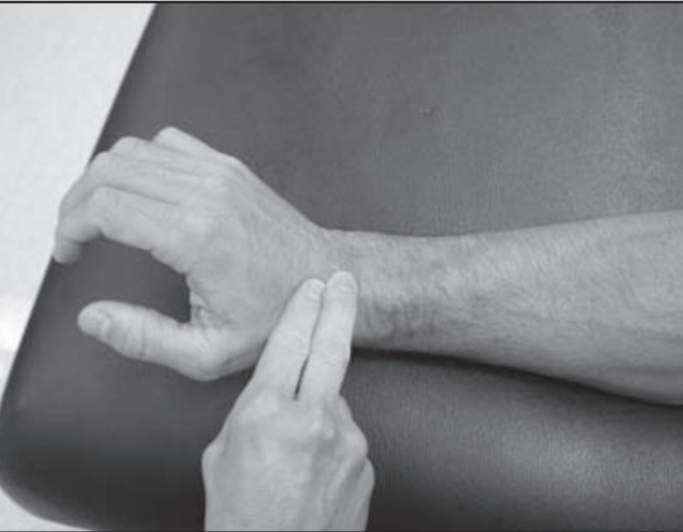 Extension ,Grades 1/5 to 0/5: MMT of wrist joint