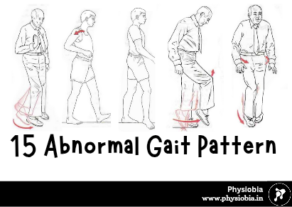 Abnormal Gait Pattern