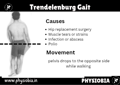 Gluteus Medius (Trendelenburg) Gait
