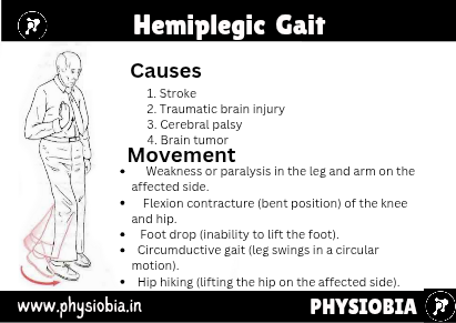 Hemiplegic Gait