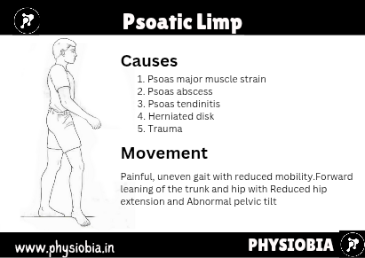 Psoatic Limp