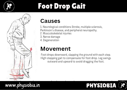 Steppage or Drop Foot Gait