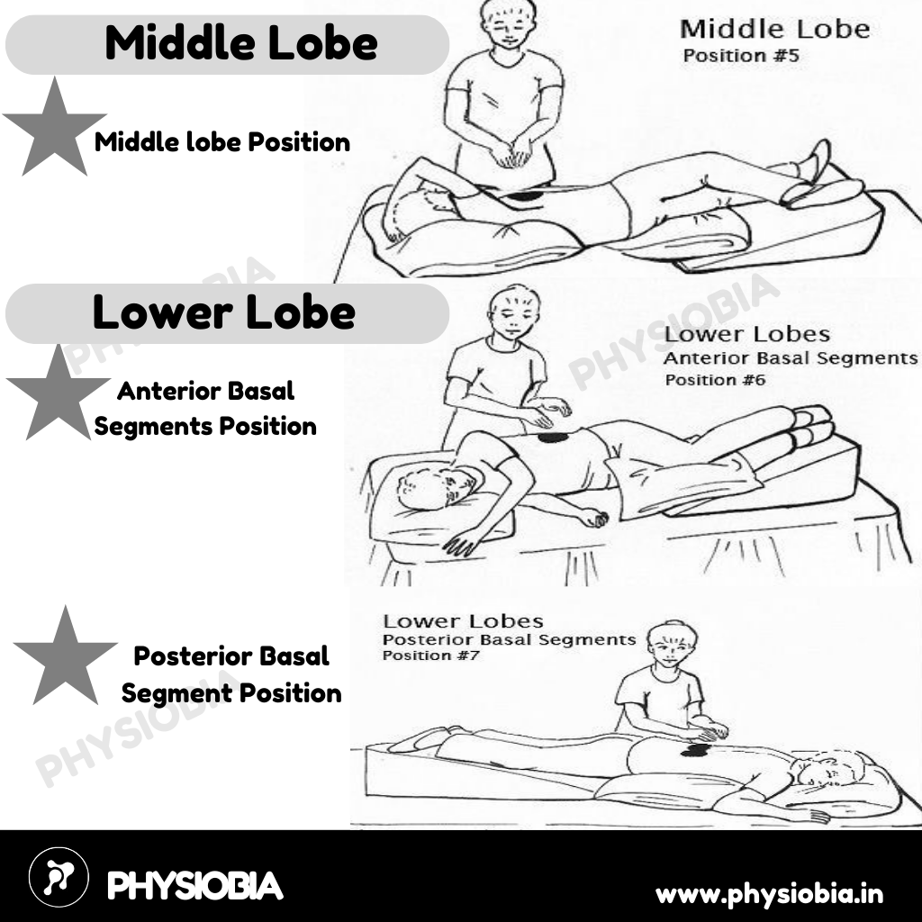 Postural drainage Positions