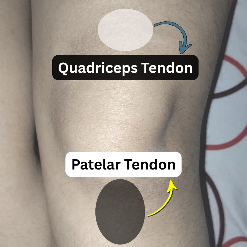 My knee hurt above and below the knee joint showing knee swelling and aching knees with highlighted pain areas and simple ways to fix knee hurt